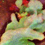 Зарождение рака кожи