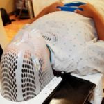 У 46 000 бельгийцев в год диагностируется рак кожи