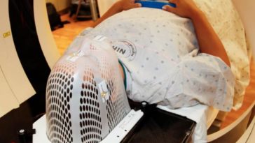 У 46 000 бельгийцев в год диагностируется рак кожи