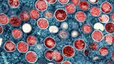 Будут ли в Бельгии вводить меры против новой, заразной разновидности вируса оспы обезьян?