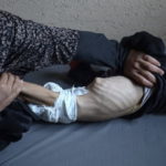 Голод как оружие использовался во все времена, но то, что происходит в Газе — почти беспрецедентно