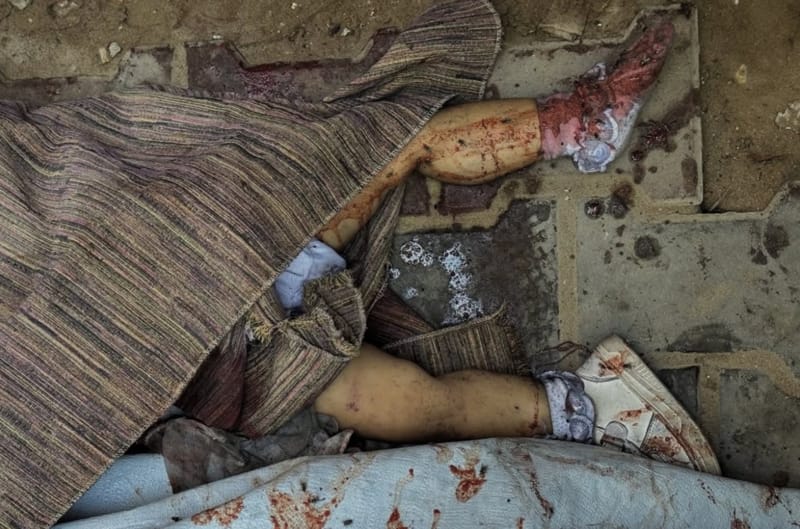 «Это антиутопия»: Врачи без границ о происходящем в Газе