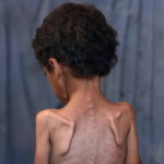 Эксперт: «Жителям Газы нужно больше, чем мука и консервы»