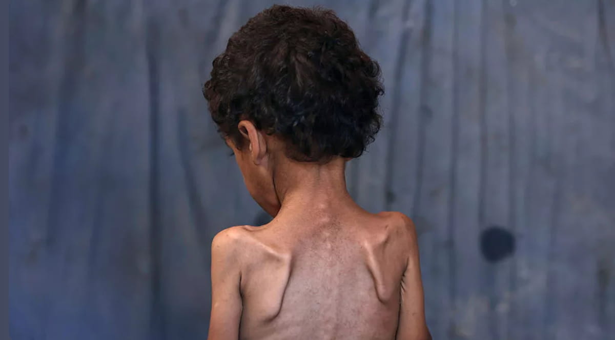 Эксперт: «Жителям Газы нужно больше, чем мука и консервы»