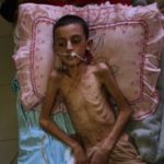 Паралич и смерть среди детей в Газе: врач из Нидерландов бьёт тревогу