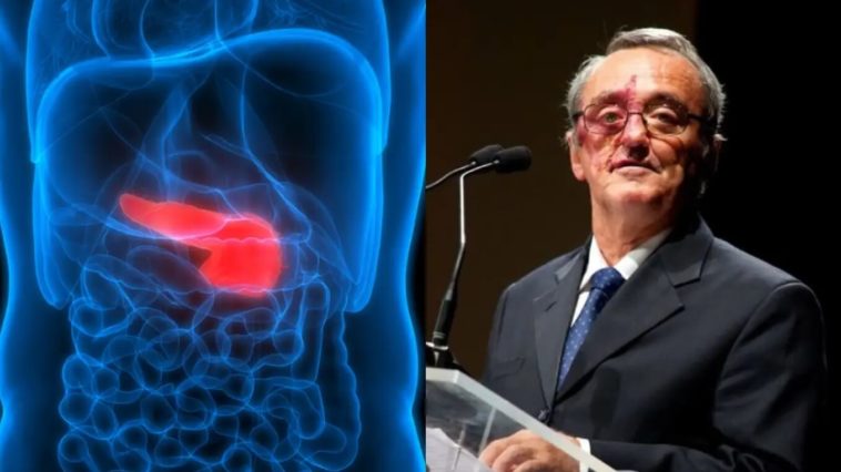 Испанские учёные заявили о прорыве в лечении рака поджелудочной железы